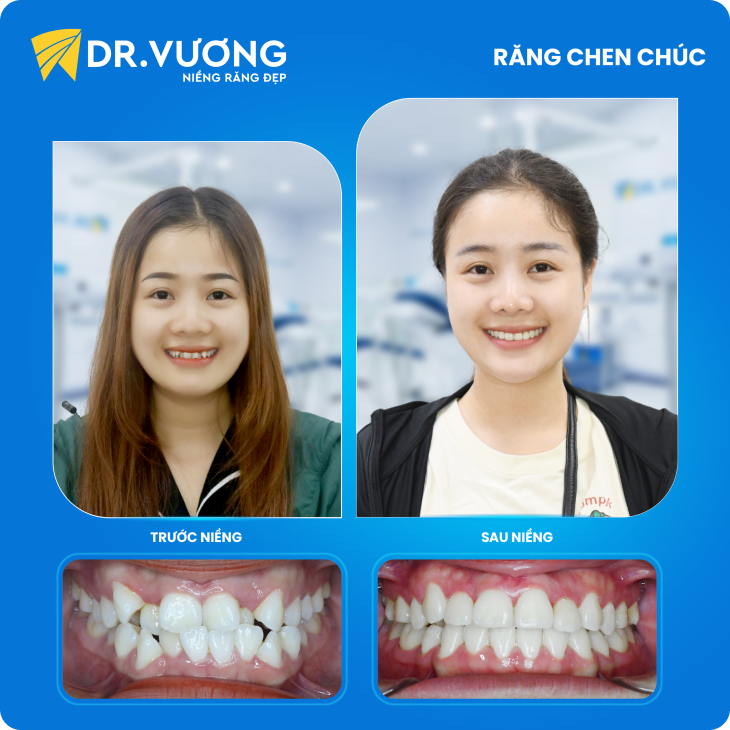 Dr. Vương