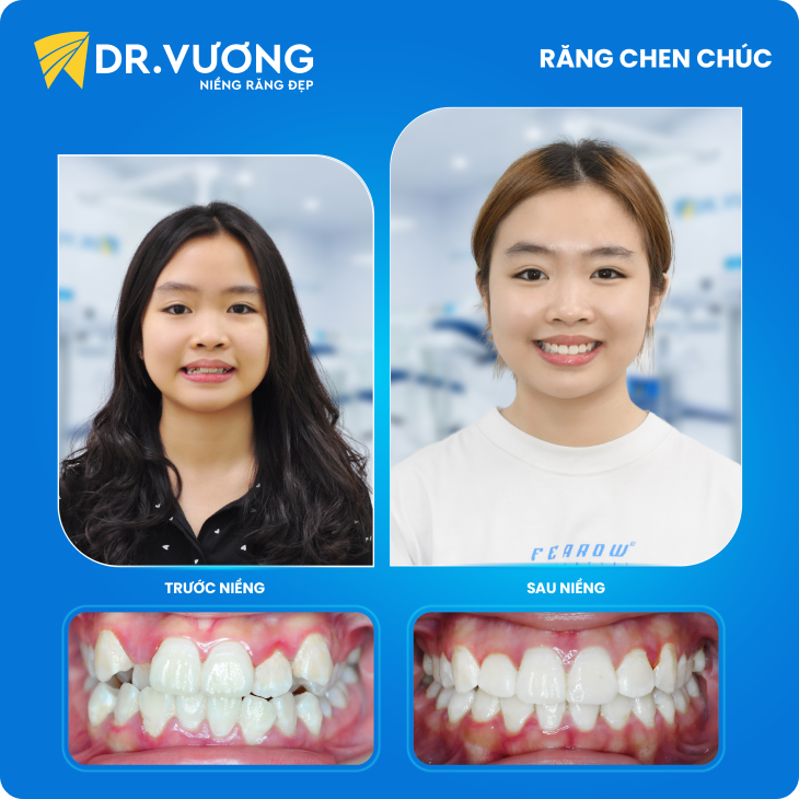 Dr. Vương