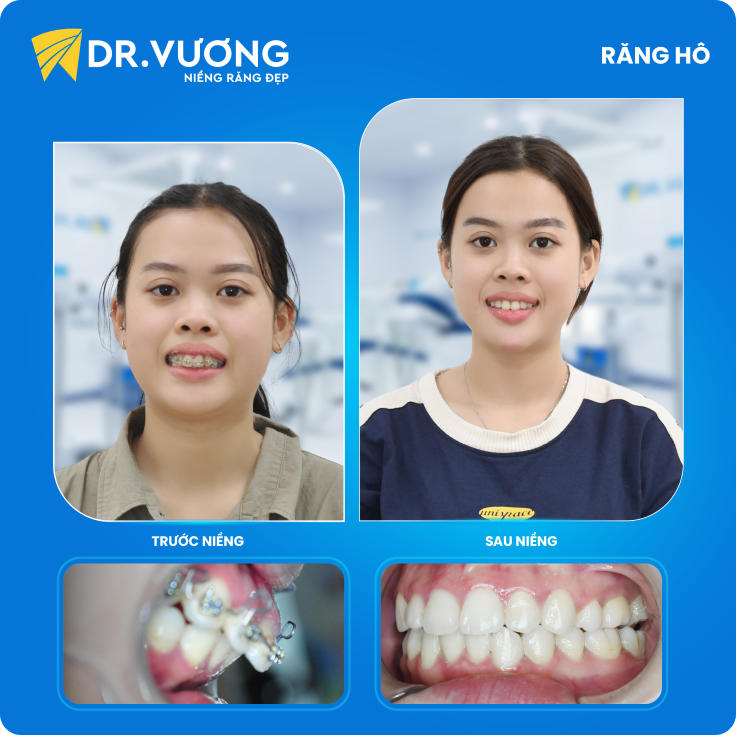 Dr. Vương
