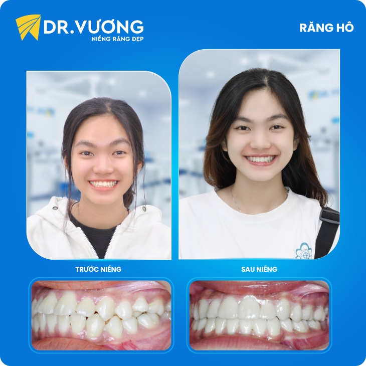 Dr. Vương