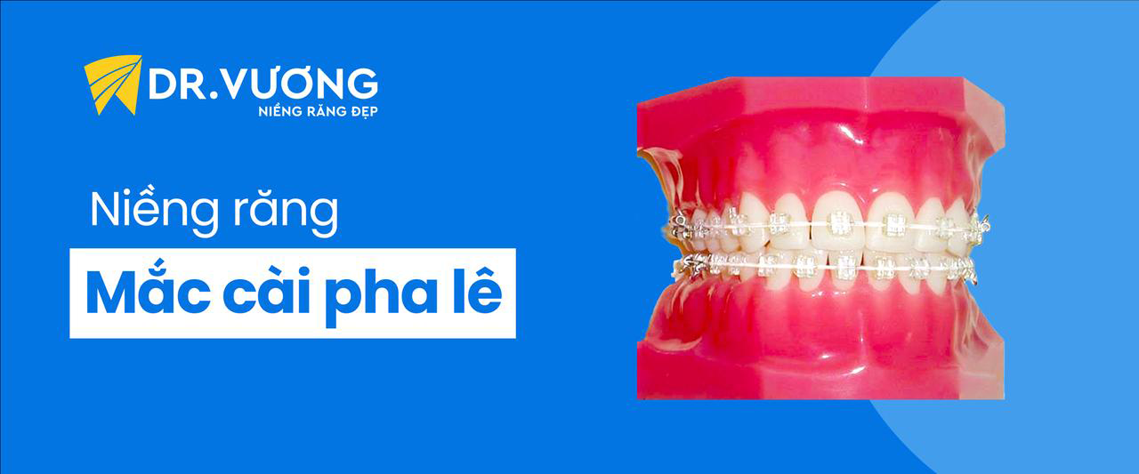 BẬT MÍ 4 PHƯƠNG PHÁP NIỀNG RĂNG TỐT NHẤT HIỆN NAY 5 2