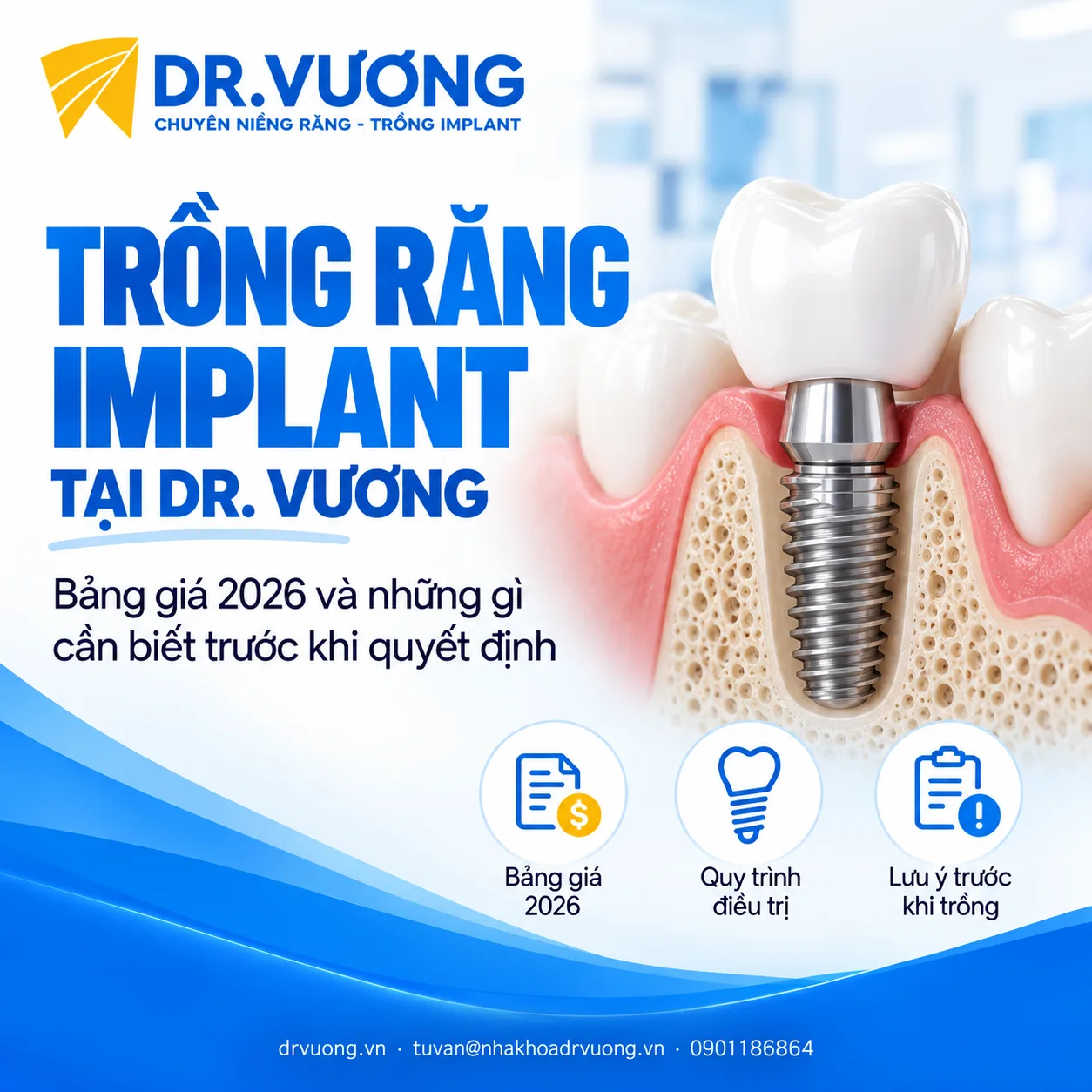 Trồng răng Implant tại DR. VƯƠNG – bảng giá 2026 và những gì cần biết trước khi quyết định 1 a45118ca 12dc 4fb5 b852 302c9a986b1a